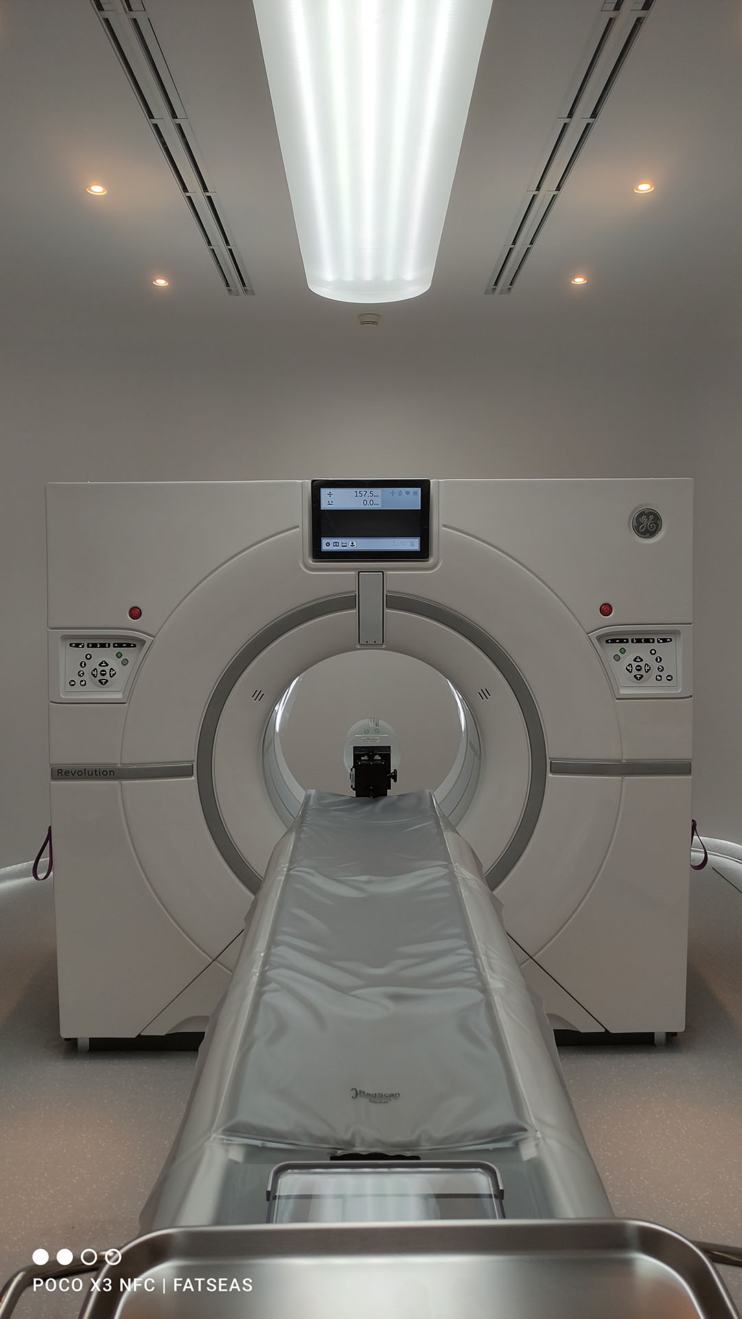 CT Scan Revolution